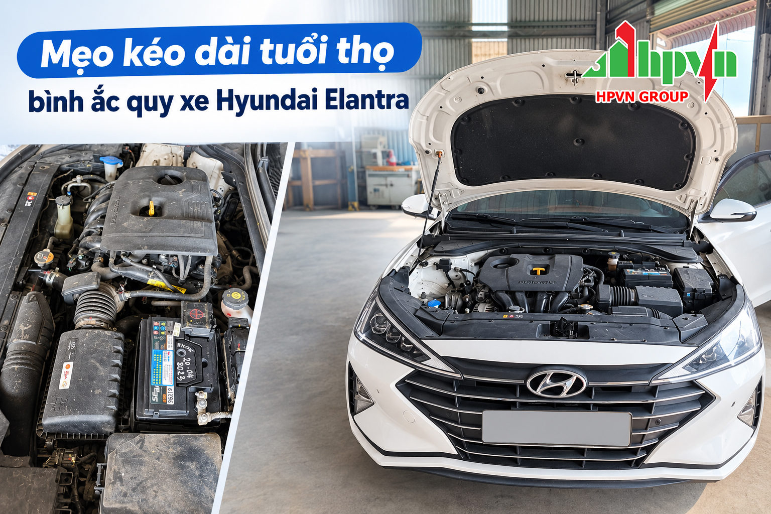Mẹo kéo dài tuổi thọ bình ắc quy xe Hyundai Elantra 